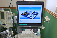 超音波画像診断装置写真